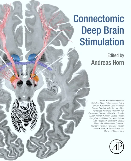 Coperta cărții "Connectomic Deep Brain Stimulation" de autor necunoscut