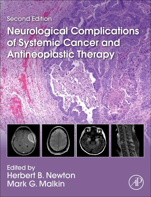 Coperta cărții "Neurological Complications of Systemic Cancer and Antineoplastic Therapy" de autor necunoscut