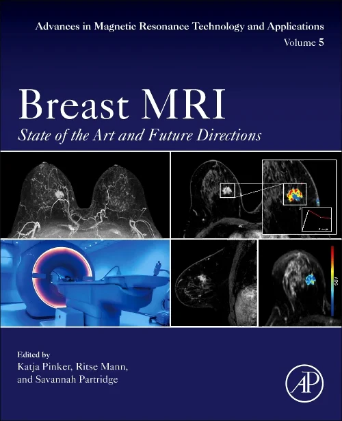 Coperta cărții "Breast MRI" de autor necunoscut