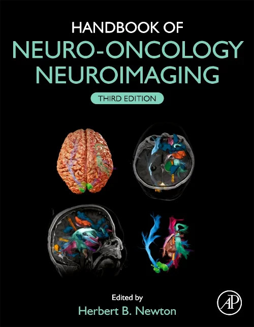 Coperta cărții "Handbook of Neuro-Oncology Neuroimaging" de autor necunoscut