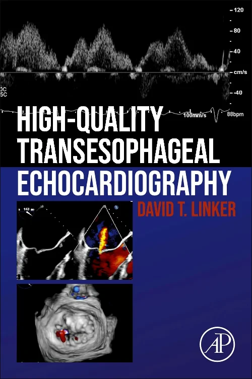 Coperta cărții "High-Quality Transesophageal Echocardiography" de autor necunoscut