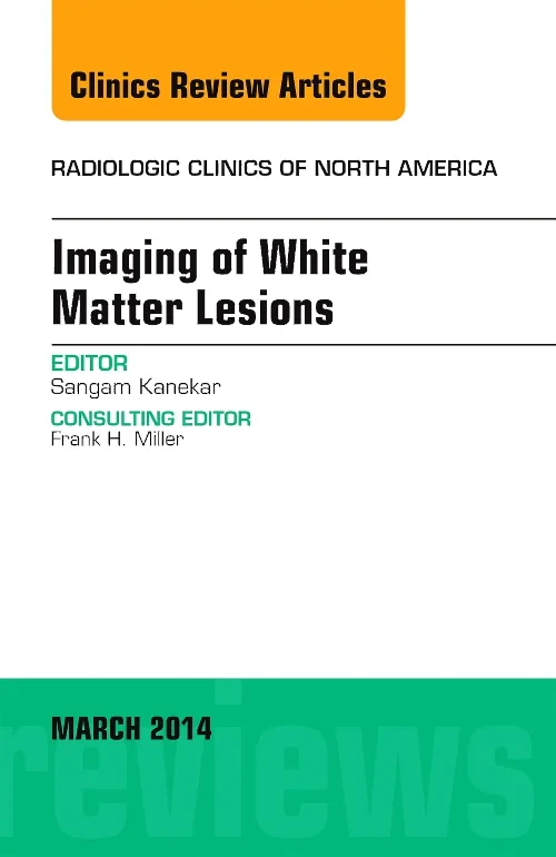 Coperta cărții "Imaging of White Matter, An Issue of Radiologic Clinics of North America" de autor necunoscut