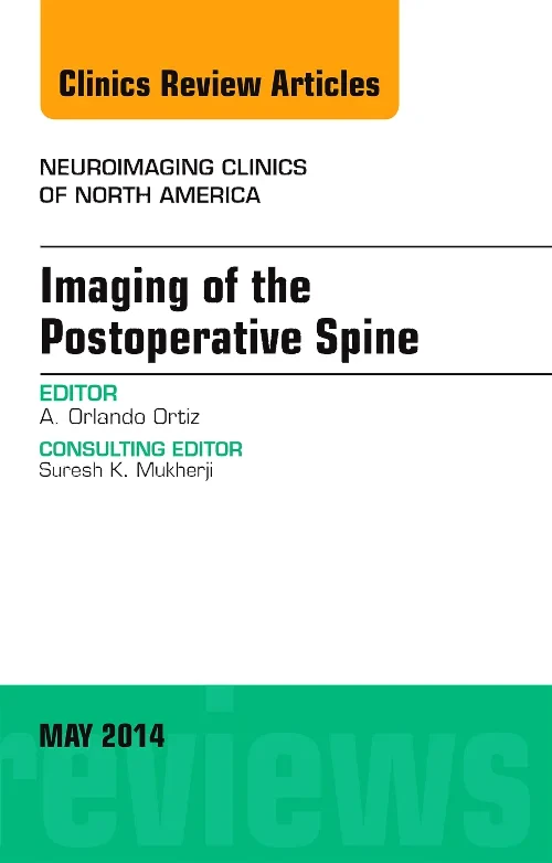 Coperta cărții "Imaging of the Postoperative Spine, An Issue of Neuroimaging Clinics" de autor necunoscut