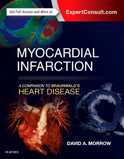 Coperta cărții "Myocardial Infarction: A Companion to Braunwald&#039;s Heart Disease" de autor necunoscut