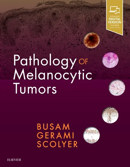 Coperta cărții "Pathology of Melanocytic Tumors" de autor necunoscut