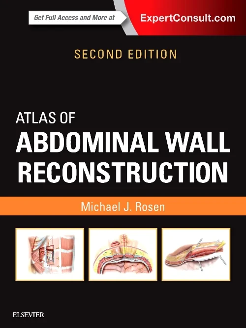 Coperta cărții "Atlas of Abdominal Wall Reconstruction" de autor necunoscut