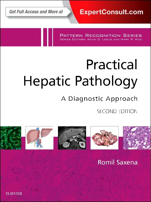 Coperta cărții "Practical Hepatic Pathology: A Diagnostic Approach" de autor necunoscut