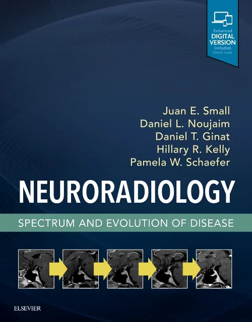 Coperta cărții "Neuroradiology: Spectrum and Evolution of Disease" de autor necunoscut