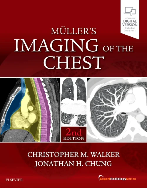 Coperta cărții "Muller&#039;s Imaging of the Chest" de autor necunoscut
