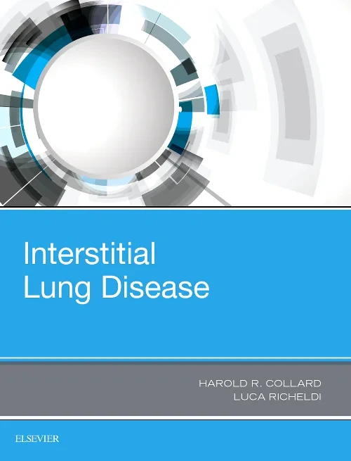 Coperta cărții "Interstitial Lung Disease" de autor necunoscut