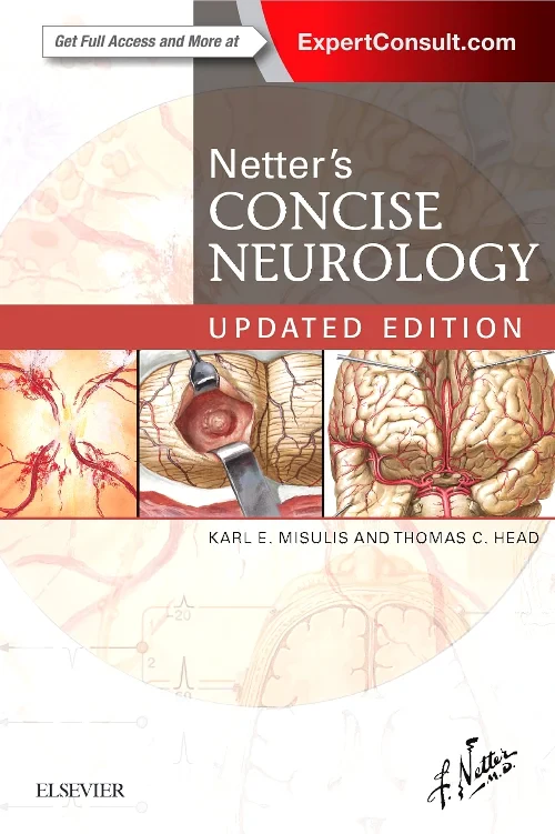 Coperta cărții "Netter&#039;s Concise Neurology Updated Edition" de autor necunoscut