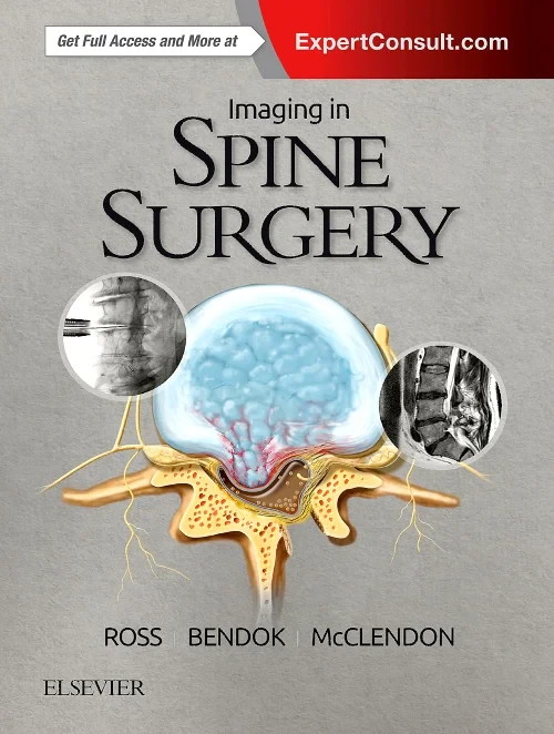 Coperta cărții "Imaging in Spine Surgery" de autor necunoscut