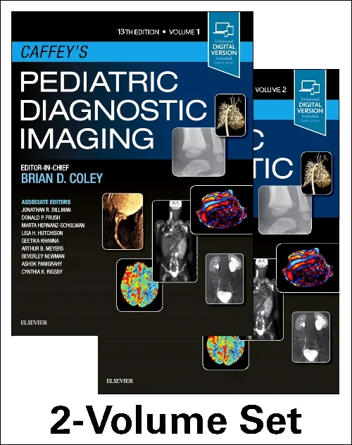 Coperta cărții "Caffey&#039;s Pediatric Diagnostic Imaging, 2-Volume Set" de autor necunoscut