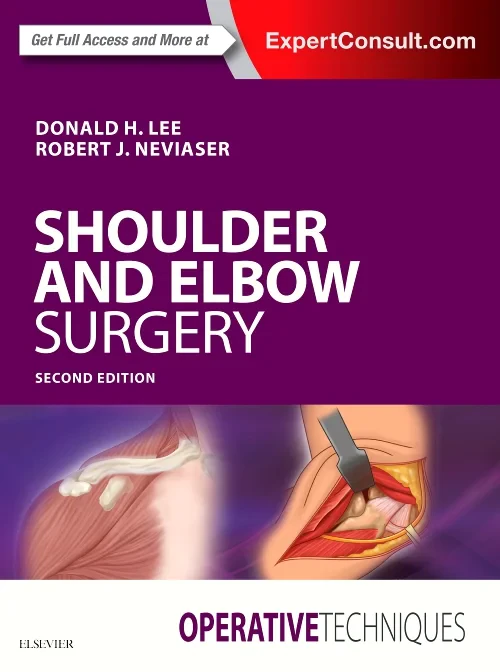 Coperta cărții "Operative Techniques: Shoulder and Elbow Surgery" de autor necunoscut