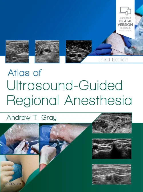 Coperta cărții "Atlas of Ultrasound-Guided Regional Anesthesia" de autor necunoscut
