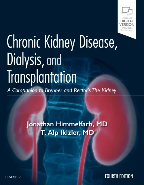 Coperta cărții "Chronic Kidney Disease, Dialysis, and Transplantation" de autor necunoscut