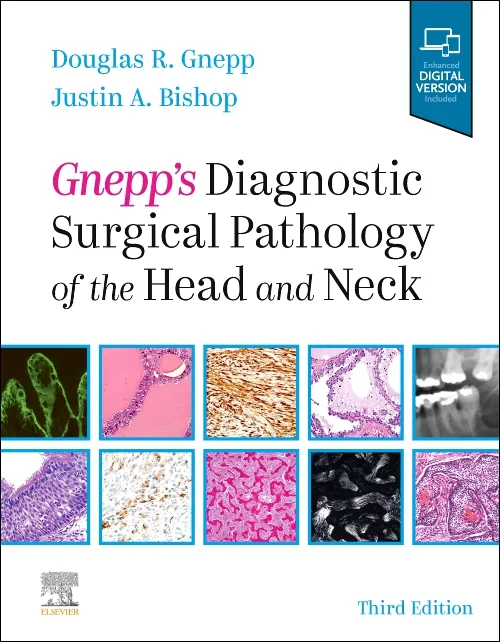 Coperta cărții "Gnepp&#039;s Diagnostic Surgical Pathology of the Head and Neck" de autor necunoscut