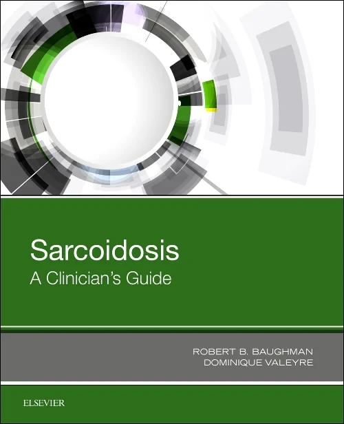 Coperta cărții "Sarcoidosis" de autor necunoscut