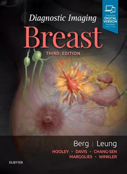 Coperta cărții "Diagnostic Imaging: Breast" de autor necunoscut