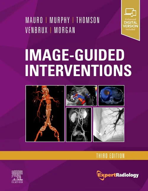 Coperta cărții "Image-Guided Interventions" de autor necunoscut