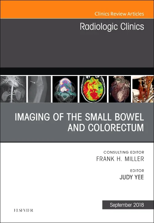 Coperta cărții "Imaging of the Small Bowel and Colorectum, An Issue of Radiologic Clinics of North America" de autor necunoscut
