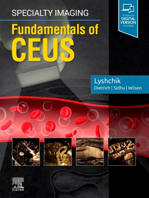 Coperta cărții "Specialty Imaging: Fundamentals of CEUS" de autor necunoscut