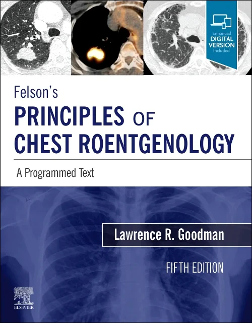 Coperta cărții "Felson&#039;s Principles of Chest Roentgenology, A Programmed Text" de autor necunoscut