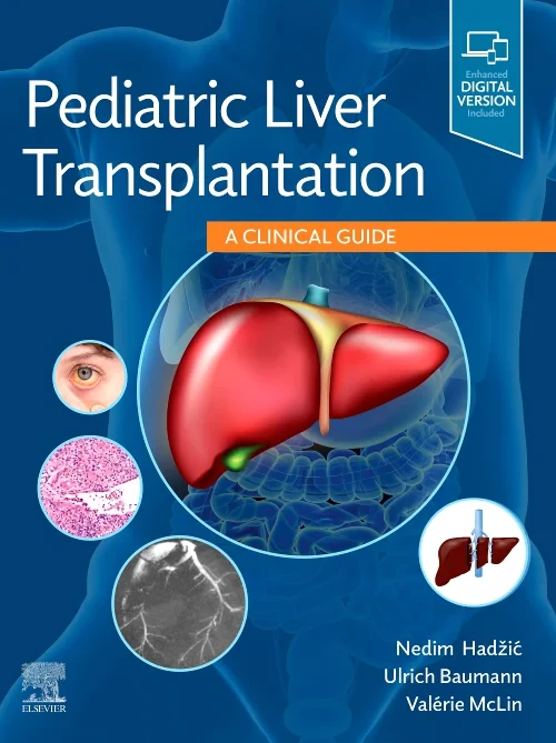 Coperta cărții "Pediatric Liver Transplantation" de autor necunoscut