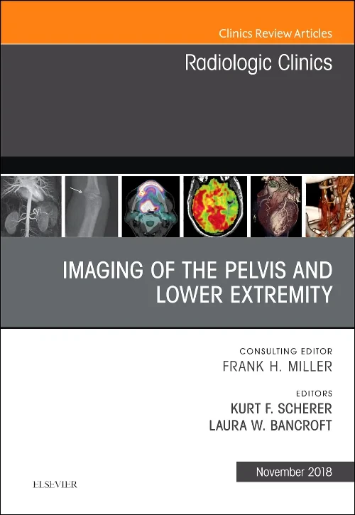 Coperta cărții "Imaging of the Pelvis and Lower Extremity, An Issue of Radiologic Clinics of North America" de autor necunoscut