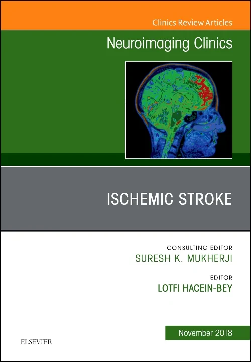 Coperta cărții "Ischemic Stroke, An Issue of Neuroimaging Clinics of North America" de autor necunoscut