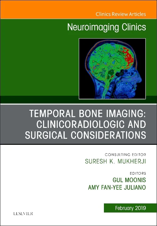 Coperta cărții "Temporal Bone Imaging: Clinicoradiologic and Surgical Considerations, An Issue of Neuroimaging Clinics of North America" de autor necunoscut