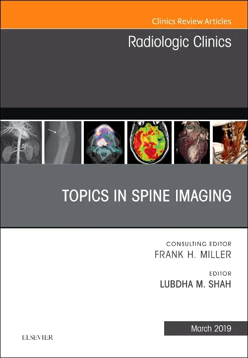 Coperta cărții "Topics in Spine Imaging, An Issue of Radiologic Clinics of North America" de autor necunoscut