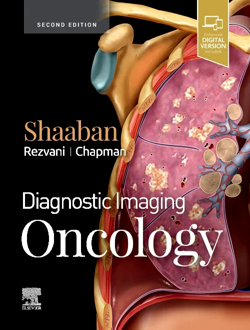 Coperta cărții "Diagnostic Imaging: Oncology" de autor necunoscut