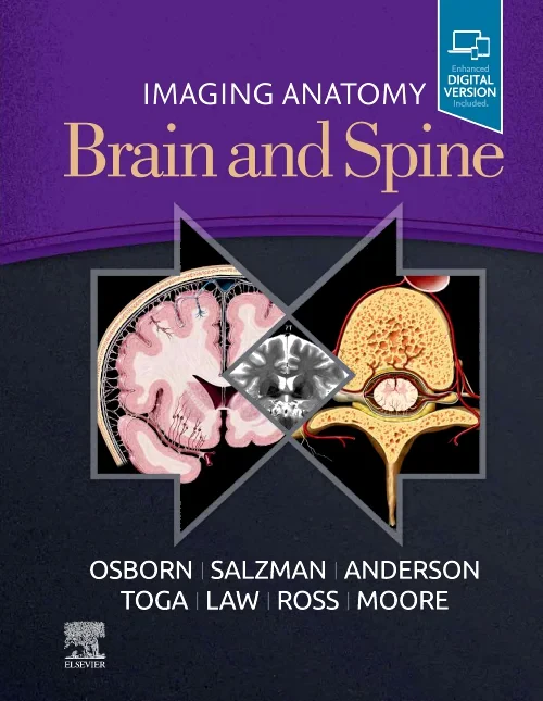 Coperta cărții "Imaging Anatomy Brain and Spine" de autor necunoscut
