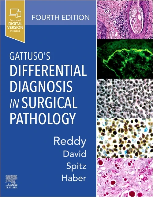 Coperta cărții "Gattuso&#039;s Differential Diagnosis in Surgical Pathology" de autor necunoscut