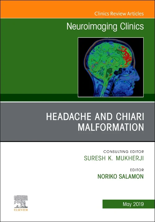 Coperta cărții "Headache and Chiari Malformation, An Issue of Neuroimaging Clinics of North America" de autor necunoscut