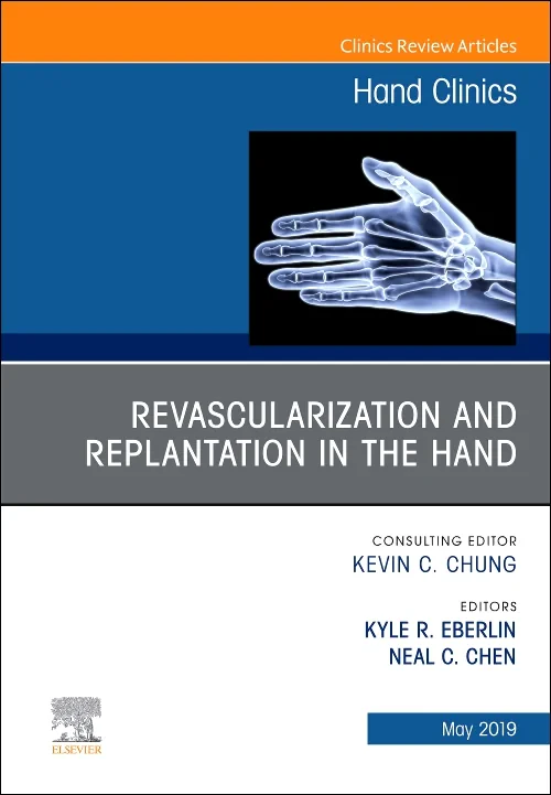 Coperta cărții "Revascularization and Replantation in the Hand, An Issue of Hand Clinics" de autor necunoscut