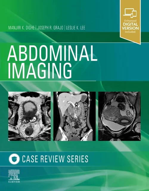 Coperta cărții "Abdominal Imaging" de autor necunoscut