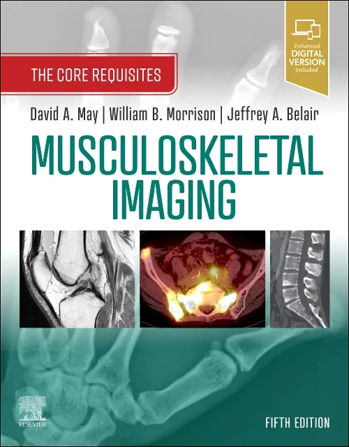 Coperta cărții "Musculoskeletal Imaging" de autor necunoscut