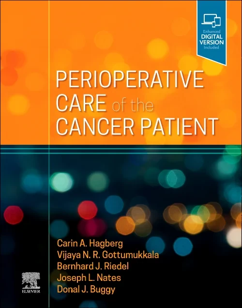 Coperta cărții "Perioperative Care of the Cancer Patient" de autor necunoscut
