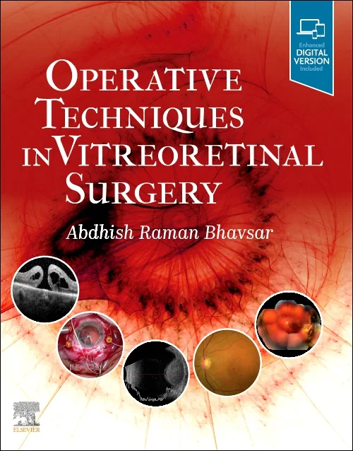 Coperta cărții "Operative Techniques in Vitreoretinal Surgery" de autor necunoscut