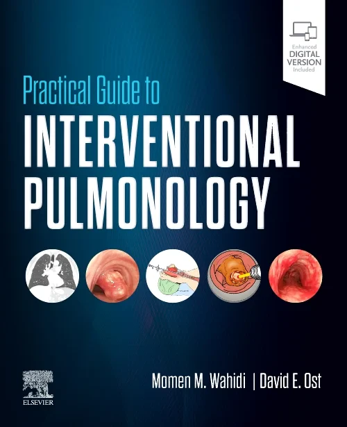 Coperta cărții "Practical Guide to Interventional Pulmonology" de autor necunoscut