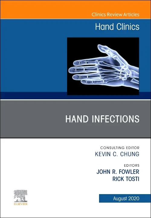 Coperta cărții "Hand Infections, An Issue of Hand Clinics" de autor necunoscut