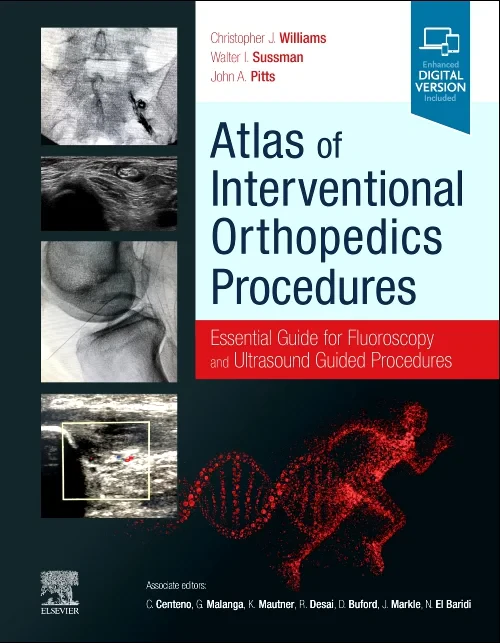 Coperta cărții "Atlas of Interventional Orthopedics Procedures" de autor necunoscut