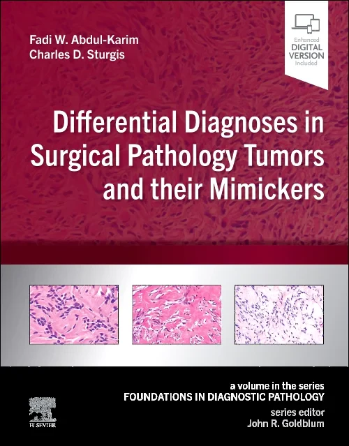 Coperta cărții "Differential Diagnoses in Surgical Pathology Tumors and their Mimickers" de autor necunoscut