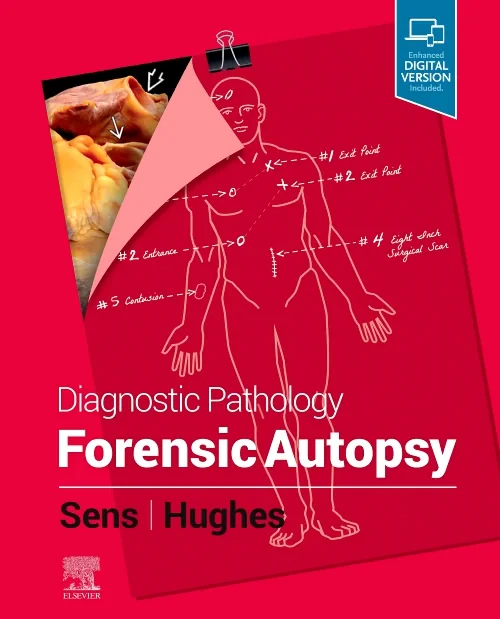 Coperta cărții "Diagnostic Pathology: Forensic Autopsy" de autor necunoscut