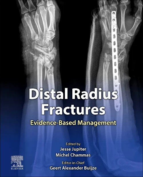 Coperta cărții "Distal Radius Fractures" de autor necunoscut