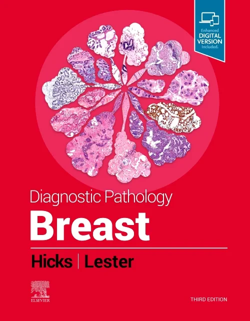 Coperta cărții "Diagnostic Pathology: Breast" de autor necunoscut