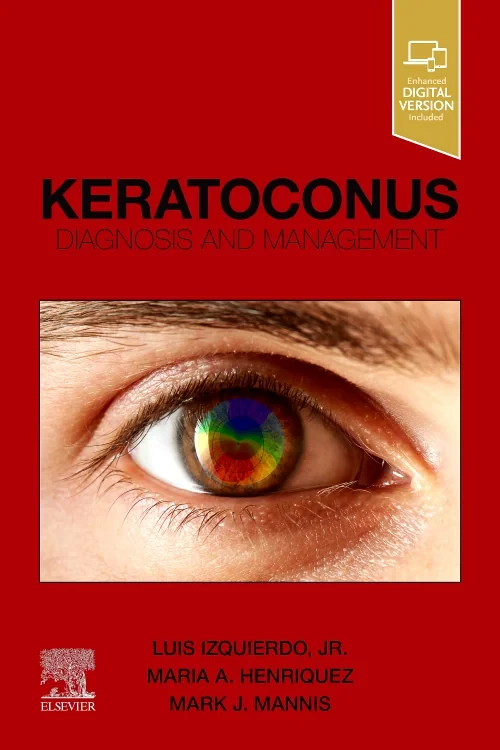 Coperta cărții "Keratoconus" de autor necunoscut