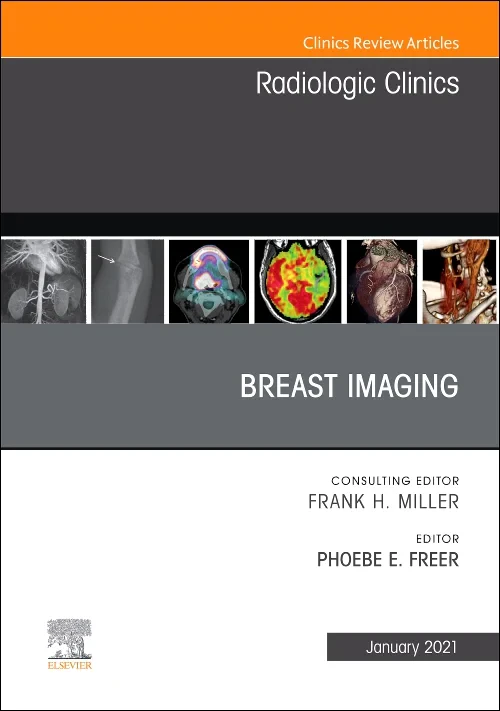 Coperta cărții "Breast Imaging, An Issue of Radiologic Clinics of North America" de autor necunoscut